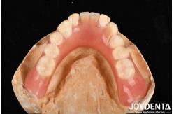 China Lightweight Good Biocompatibility Acrylic Denture Finish Personalized Customization In Medical Equipment supplier