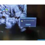 Report Power Management Error Ultrasound Machine Repair Replace Power Supply GE Voluson E10 for sale