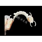 Custom Cast Partial Denture with HPP framework for Enhanced Chewing and Speech for sale