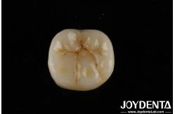 China High Translucency Full Zirconia With Layers Biocompatibility And Flexural Strength Of 800 MPa supplier