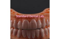 China OEM ODM Pop On Veneers Custom Made Veneers Snap On Smile supplier
