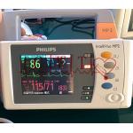 PHiliph MP2 Used Patient Monitor for sale