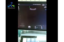 China Ultrasound Image Without Echo Ultrasound Machine Repair Replace RFM Board supplier