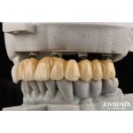 Close Friends Of Bones Foundation Of Beauty Zirconia Implants Aesthetically Supreme Choice With No Risk Of Metal Allergy for sale