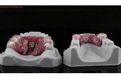 China Teeth Expansion And Distalization Adjusting Expander In Mouth Orthodontist Palate Expander supplier