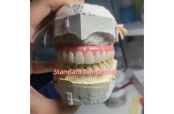 China Screw Retained Titanium PMMA Dental Bridge Temporary Crown supplier