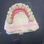 Malo Bridge Hybrid Zirconia All On Four / Six Zirconia Implant Bridge TItanium Bar