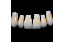 China High Translucency Emax Porcelain Veneers Crown with Better Materials by Ivoclar Vivadent supplier