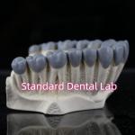 SDL Dental Lab Digital Diagnostic Wax Ups Crown Bridge for sale
