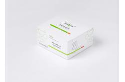 China Serum Plasma Cystatin C Test Kit supplier