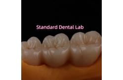 China Crown All Porcelain Ceramic Zirconia Ivoclar Esthetic Teeth OEM supplier