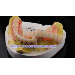 High Esthetics Dental TCS Valplast Flexible Partial Dentures Dental Lab Valplast Clasp Pink Shade for sale