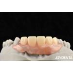 Elaborate Technology Framework Set Up Teeth Finish For Stable Oral Structure In Dental Technology Apply To Dental for sale