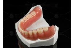 China High Esthetics Removable Full Acrylic Denture Acrylic Complete Denture supplier