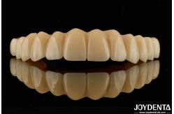China Titanium Base Zirconia Hybrid Bridge High Corrosion Resistance Customization Needs supplier