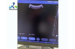 China Siemens X300 Ultrasound Machine Repair Service Unable To Enter The System After Booting supplier