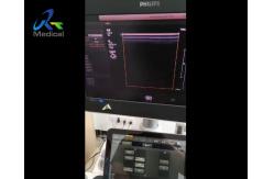 China EPIQ 5 Ultrasound Machine Repair Abnormal Image Snowflake Interference Replace ACQ supplier