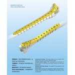 Plate and Screw Distal Medial Femur Plates(L/R) Titanium Implant