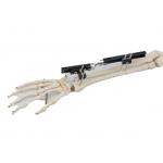 Sterilized Bone Fracture Distal Radius External Fixator for sale