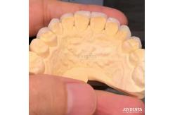 China Customized Shades To Match Natural Teeth Biocompatible And Stain Resistant Dental Veneers supplier