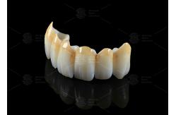 China High Translucency Full Contour Zirconia Bridge Chipping Resistance Natural Esthetics supplier
