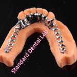 Laser Printing Cobalt Chrome Metal Framework Partial Denture Ni Be Free for sale