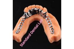 China Laser Printing Cobalt Chrome Metal Framework Partial Denture Ni Be Free supplier