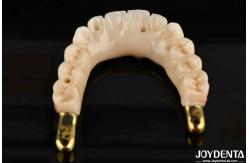 China Dental Prosthesis Ti-Bar Zirconia Hybrid Bridge With High Biocompatibility Standards supplier