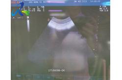 China CA431 convex probe ultrasound For Abdominal Vascular ultrasonic cleaning probe supplier