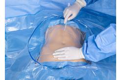 China Nonwoven Fabric Disposable Sterile Surgical C Section Pack Caesarean Drape OEM Service supplier