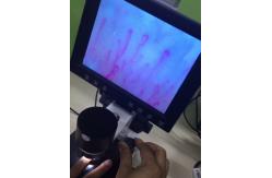 China Next Generation Microcirculation Microscope , Blood Vessel Microscope For Healthcare supplier