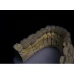 Layered Porcelain Fused Zirconia for sale