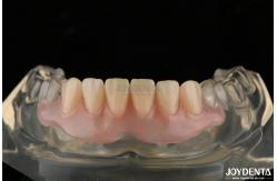China Personalized Invisible Denture Finished With Advanced Tooth Arrangement Technology supplier