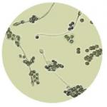 Anti Sperm Antibody IgG Test Kit MAR AsAb For Immunological Infertility for sale