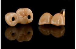 China Self Tapping 3.0mm Thread Dental Titanium Implant Optimized Functionality supplier