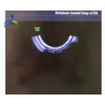 Repair GE Voluson E10 RFM423 KTZ304074  5729200 KTZ304073 Image Missing Ultrasound for sale