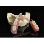 Lightweight Durable Flexible Removable Partial Denture Comfortable Dental Prosthesis Ideal for Long Term and Easy Maintenance for sale