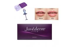 China 2ml Lip Injections Juvederm Hyaluronic Acid Dermal Filler supplier