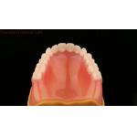Complete Denture Ivoclar Full Denture Acrylic Teeth SDL Dental Lab for sale