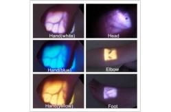 China Projection Infrared Medical Vein Finder Detector , Higher Accuracy Venipuncture supplier