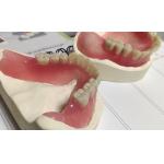 Hot Cured Removable Aesthetic Lower Partial Acrylic Denture for sale