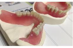 China Hot Cured Removable Aesthetic Lower Partial Acrylic Denture supplier