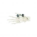 Factory Price Mini Fragment Orthopedic Orthofix External Fixator With Pins For Finger for sale