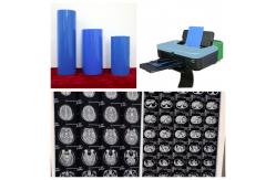 China High Durability Inkjet Blue Medical X Ray Film Long Lasting Blue Image Stabilization supplier