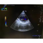 GE 3SC-RS Ultrasound Probe Repair Original Crystal Array Replacement for sale