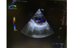 China GE 3SC-RS Ultrasound Probe Repair Original Crystal Array Replacement supplier