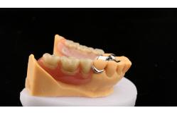 China Metal Alloys Cobalt Chromium Partial Denture Ivoclar Scheftner Comfortable Cast Metal Framewrok supplier