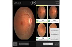 China Intuitive Ultra Wide Field Fundus Camera 35mm Imaging System supplier