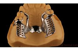 China Metal Alloys Partial Cobalt Chrome Dentures Ivoclar Scheftner Comfortable China Dental Lab supplier