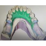 Removable 3D Printed Partial Denture Metal Framework for sale